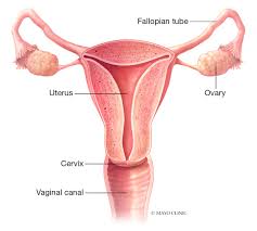 Female Infertility